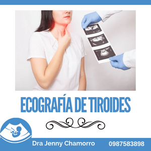 Ecografía de Tiroides