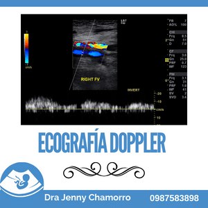 Ecografía Doppler