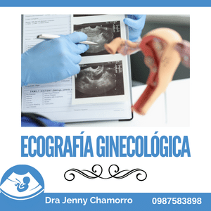 Ecografía Ginecológica